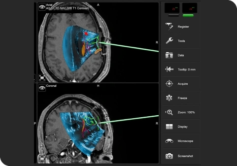 Neuro Navigation & Neuro Endoscope Systems